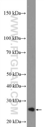RP9 Antibody in Western Blot (WB)