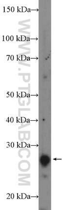 RP9 Antibody in Western Blot (WB)