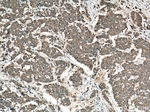 KRT80 Antibody in Immunohistochemistry (Paraffin) (IHC (P))