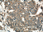 KRT80 Antibody in Immunohistochemistry (Paraffin) (IHC (P))