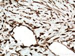 KRT80 Antibody in Immunohistochemistry (Paraffin) (IHC (P))