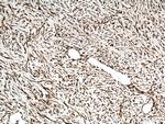 KRT80 Antibody in Immunohistochemistry (Paraffin) (IHC (P))