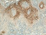 KRT80 Antibody in Immunohistochemistry (Paraffin) (IHC (P))