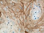KRT80 Antibody in Immunohistochemistry (Paraffin) (IHC (P))