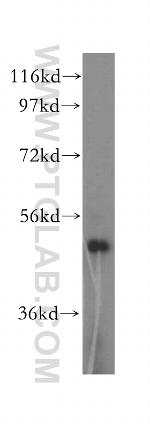 KRT80 Antibody in Western Blot (WB)