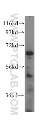 KRT80 Antibody in Western Blot (WB)