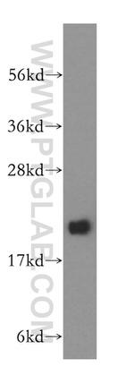 NIP7 Antibody in Western Blot (WB)