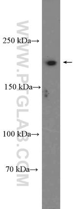 SETBP1 Antibody in Western Blot (WB)