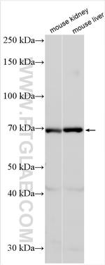 OAT3/SLC22A8 Antibody in Western Blot (WB)