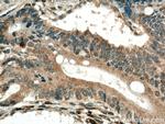 GPX8 Antibody in Immunohistochemistry (Paraffin) (IHC (P))