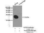 GPX8 Antibody in Immunoprecipitation (IP)