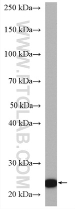 GPX8 Antibody in Western Blot (WB)