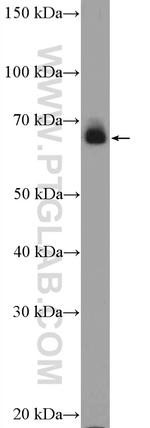 Cytokeratin 1 Antibody in Western Blot (WB)