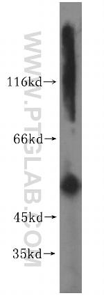 Cytokeratin 6A Antibody in Western Blot (WB)