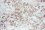 Cytokeratin 10 Antibody in Immunohistochemistry (Paraffin) (IHC (P))