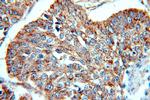 Cytokeratin 10 Antibody in Immunohistochemistry (Paraffin) (IHC (P))