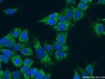 FMO5 Antibody in Immunocytochemistry (ICC/IF)