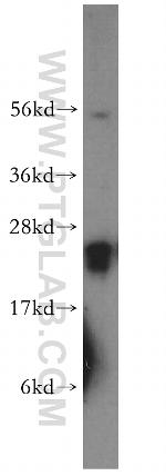 RAB3C Antibody in Western Blot (WB)