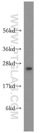 RAB3C Antibody in Western Blot (WB)