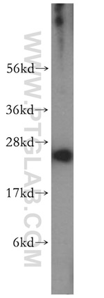 RAB27A Antibody in Western Blot (WB)