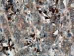 Pepsinogen II Antibody in Immunohistochemistry (Paraffin) (IHC (P))