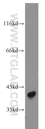Pepsinogen II Antibody in Western Blot (WB)