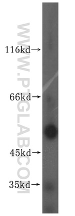 ZNHIT2 Antibody in Western Blot (WB)