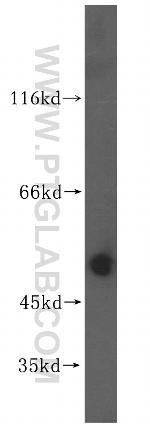 ZNHIT2 Antibody in Western Blot (WB)