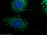 MTCH2 Antibody in Immunocytochemistry (ICC/IF)