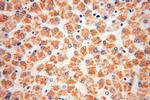 MTCH2 Antibody in Immunohistochemistry (Paraffin) (IHC (P))