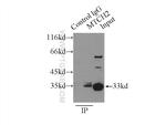 MTCH2 Antibody in Immunoprecipitation (IP)