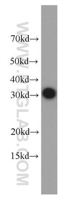 MTCH2 Antibody in Western Blot (WB)