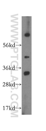 MTCH2 Antibody in Western Blot (WB)