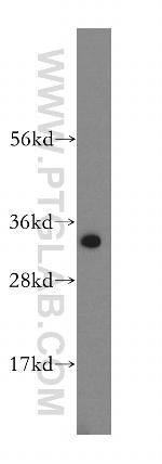 MTCH2 Antibody in Western Blot (WB)