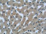 C1qC Antibody in Immunohistochemistry (Paraffin) (IHC (P))