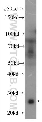 C1qC Antibody in Western Blot (WB)