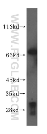 VPS33A Antibody in Western Blot (WB)