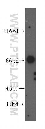 VPS33A Antibody in Western Blot (WB)