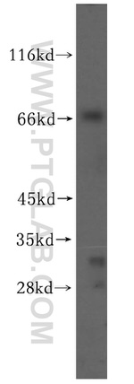VPS33A Antibody in Western Blot (WB)