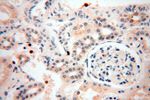 UNC13D/Munc13-4 Antibody in Immunohistochemistry (Paraffin) (IHC (P))
