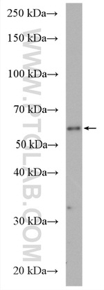 PIGT Antibody in Western Blot (WB)
