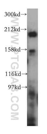 gp210 Antibody in Western Blot (WB)