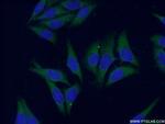 CES1 Antibody in Immunocytochemistry (ICC/IF)
