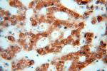 CES1 Antibody in Immunohistochemistry (Paraffin) (IHC (P))