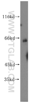 CES1 Antibody in Western Blot (WB)