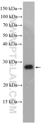 FAM156A Antibody in Western Blot (WB)