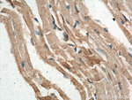 FAM156A Antibody in Immunohistochemistry (Paraffin) (IHC (P))