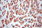 FAM156A Antibody in Immunohistochemistry (Paraffin) (IHC (P))