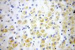 FAM156A Antibody in Immunohistochemistry (Paraffin) (IHC (P))