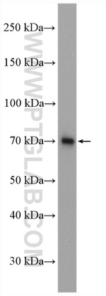 KLHDC4 Antibody in Western Blot (WB)
